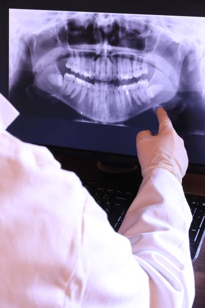 Best Emergency Root Canal Therapy in Hornsby Bend, TX